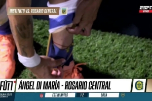 造点遭质疑，迪马利亚采访中展示小腿伤痕